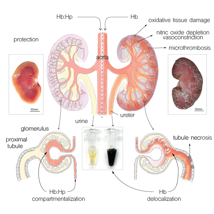 research primers_Kidney